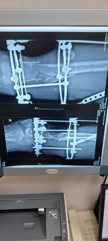 ���� �� ������� ����� ������� ������ �� �������� ��� ����������� ��������