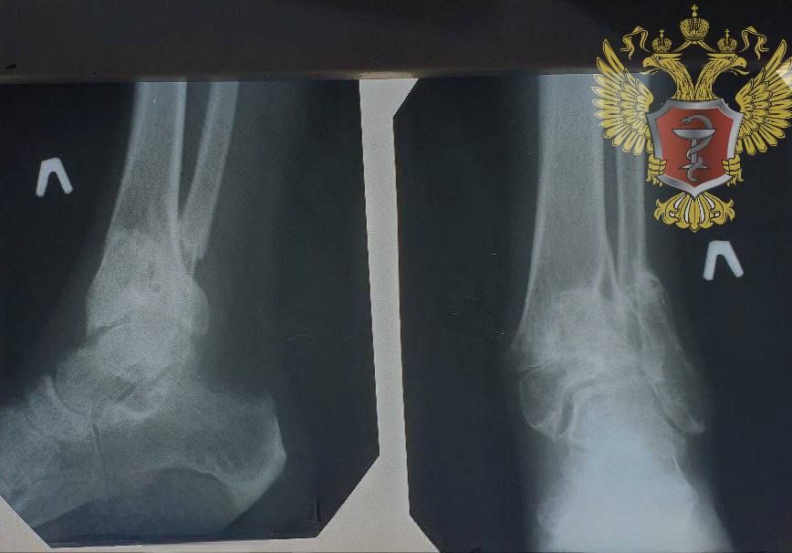 ������ ������������������� �������� � ���������� ������ �����������-������� �� ������� ��������� � ���������� ��������