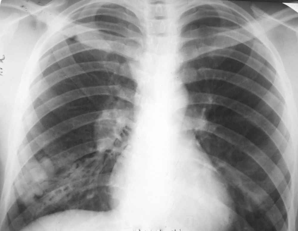 24 ����� – ��������� ���� ������ � ������������