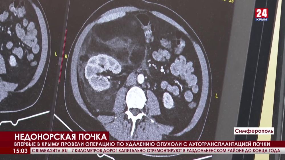 ������� � ����� ������� �������� �� �������� ������� � ������������������� �����