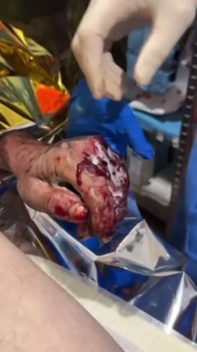 ���������� ���������, ���-���� ������ ������� ��������� �������������� ������� ������ ��� �� ������ �� ������ �����