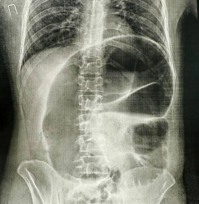 ������� ���������� �������� ������ ����� �������� � ���������� ����������� ����� �� 360�