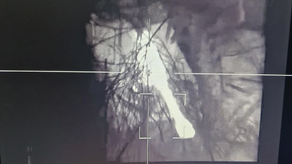 ���������� 106 ��� ���������� M109 ��������� �� ��������� �����������