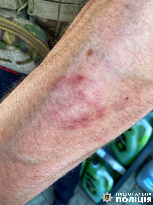 � �������������� ���������� ������� ������ ������� ������� ������� ������������, ����� �� 23-������ ��� ���� �������� �� ����������� ���