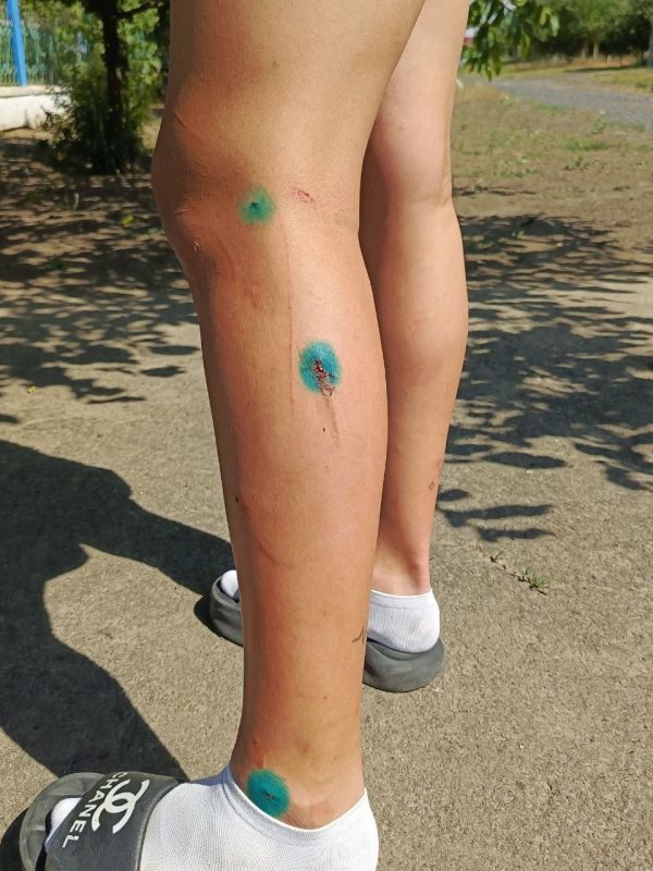 � ���������� ����� ����������� ����� 13-������ ��� �� �������� �������� ������� � ���� � ��������