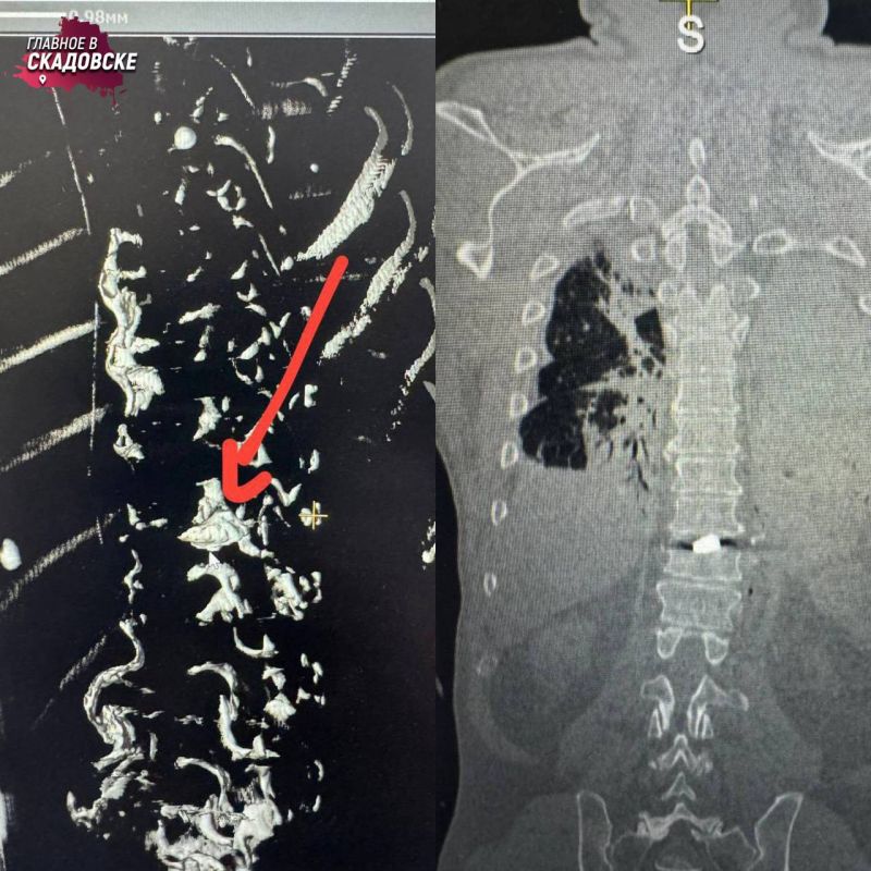 � ���������� ��� ������� ���������� ������ ������������� ��-�� ��������� �� ������� ��� �� ����� ������� � ������ ������� ��������� �� ������� � ���