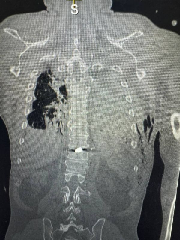 ������� ���������� �������� � ���������� �������� ������������ ��������� �� ������������������ ������� � ������