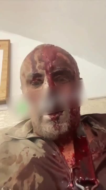 ��� ����������� ����������� �����