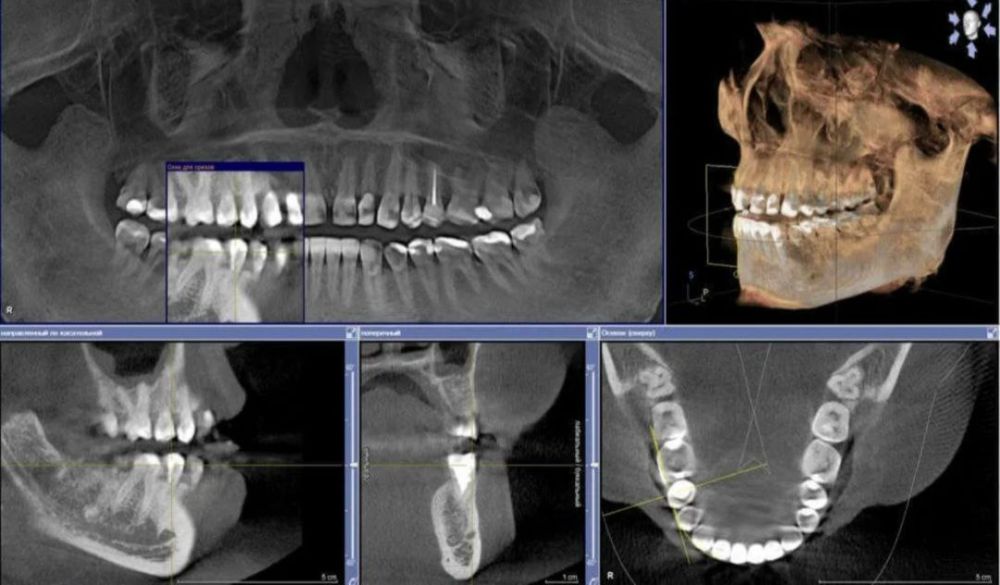 ��� ������� ����� �������� � ���������� ������� ��������� ��������� �� ���������� 3D-����������� �������