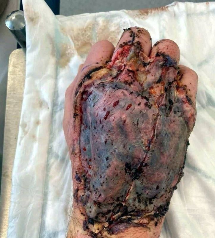 С передовой поступают сообщения об использовании противником против российских бойцов опасных отравляющих веществ