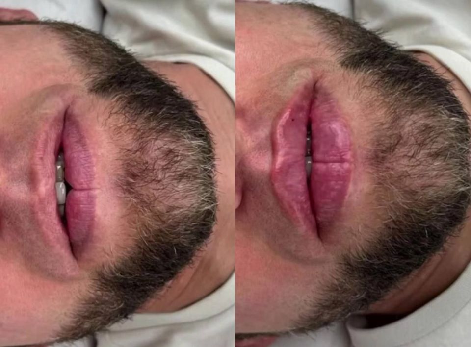 ���������� ��� ��� ������ �������� ������������ ����� ���������