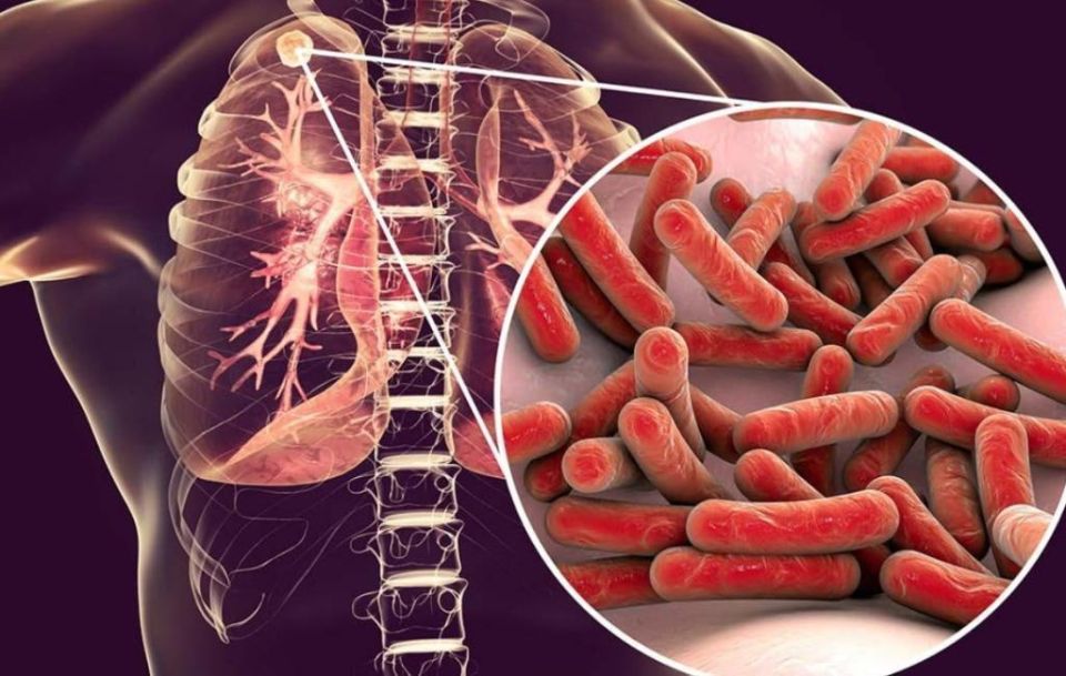 ���������: �� ������� � ����������� ������� ������