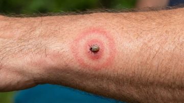 � ��������� ���������� ������� ���������� � ����� ������������ �� ������ ������