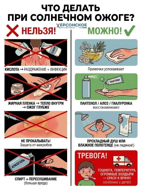 Простые правила. Что делать при солнечном ожоге?