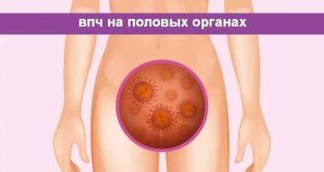Аногенитальные (венерические) бородавки — это не только эстетическая проблема