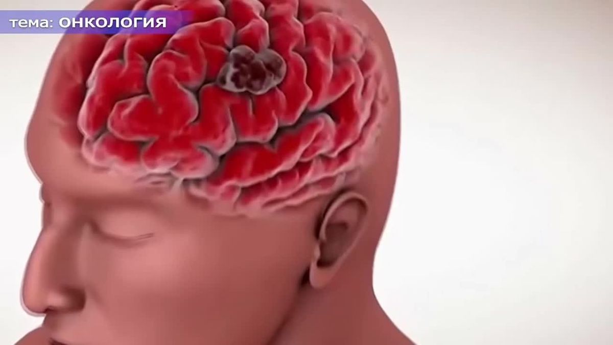 Онкология: раннее выявление спасает жизни